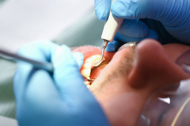 Best Emergency Treatment for Toothache in Stanton, CA