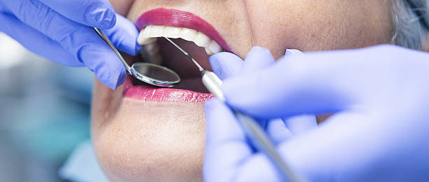 Best Pediatric Emergency Dentist in Stanton, CA
